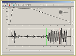 Blood Pressure Data Acquistion Software